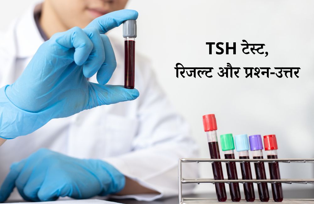TSH Test: थायराइड उत्तेजक हार्मोन क्या है, टेस्ट रिजल्ट, नॉर्मल रेंज – TSH Test in Hindi